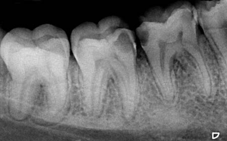 Zdjęcie RTG zębów
